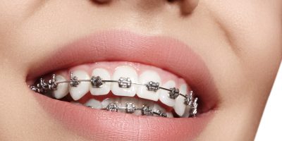 OrthodontistNearMeVista