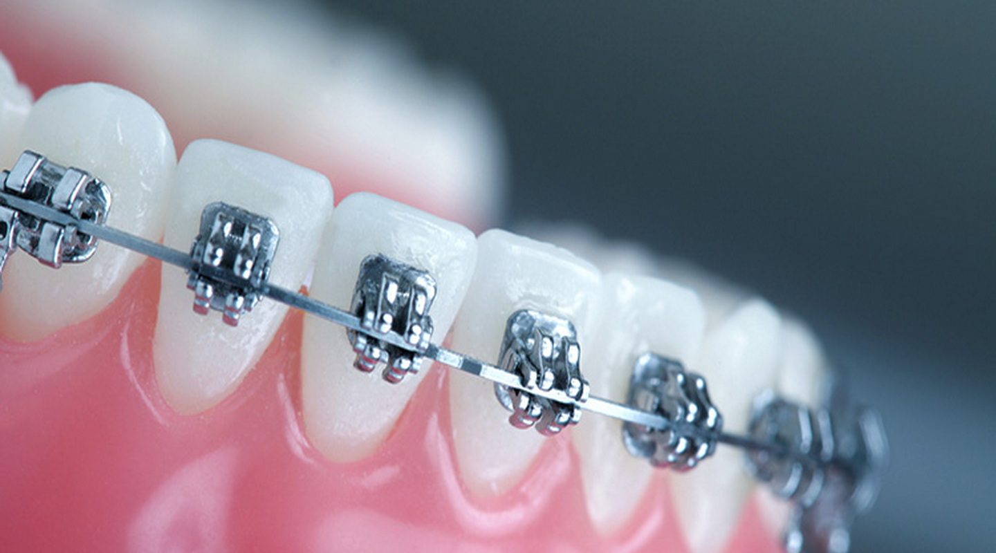 orthodontics